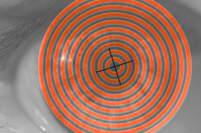 Una simulazione d'uso del topografo, che proietta una serie di anelli concentrici sulla cornea