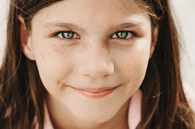 Gli occhi di una bambina; oggi è possibile preservarli, utilizzando lenti a contatto morbide per frenare la progressione miopica